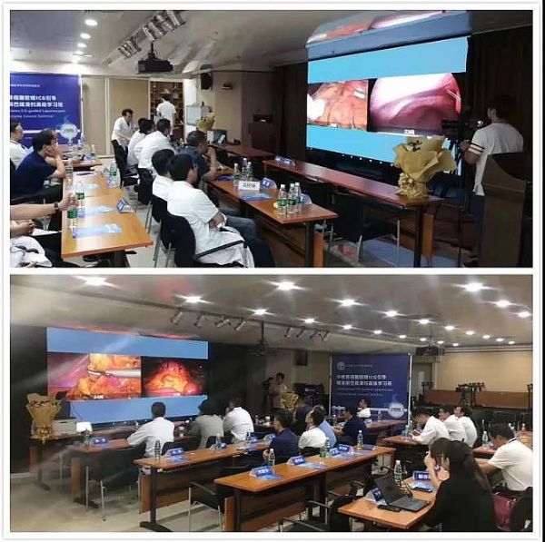 ��һ�t(y��)���Ŀ�ɹ���أ����������ǻ��t(y��)���r�����ٵ�����