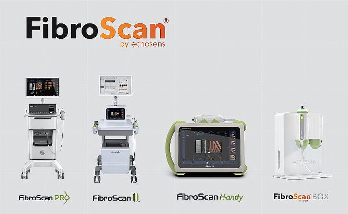 ݼ໼FibroScan ιܼв\xP(gun)zy(c)(xing)Ŀ{t(y)