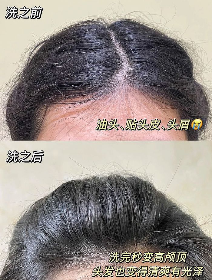 ȫ���m�õ�ȥм����ϴ�l(f��)ˮ�x�Ă�(g��)��2026ȫ���g�οڱ�֮��������С���^�l(f��)���Ͷ����Ŀ��������